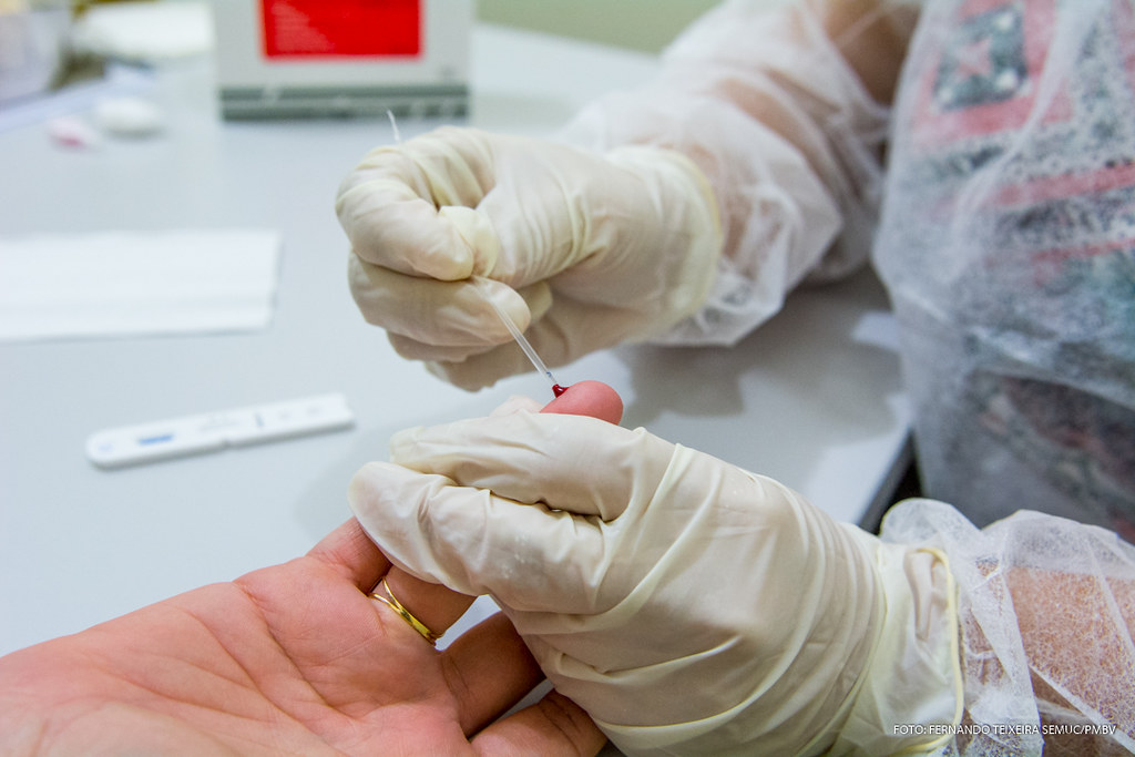 Testes rápidos nas UBSs de Boa Vista permitem diagnóstico de doenças virais em até 30 minutos